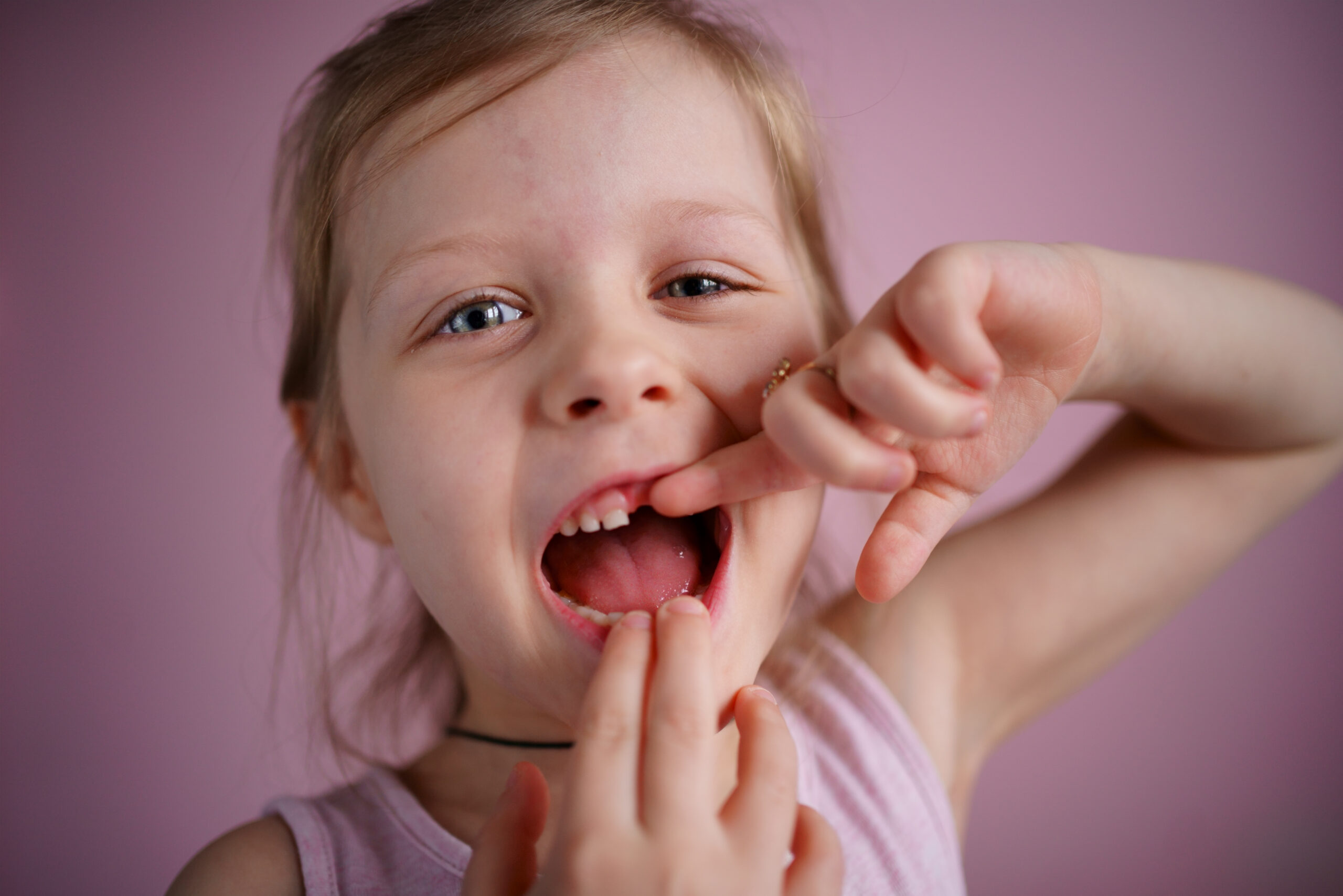 girl smiles without a front tooth Niña señalando su dentadura con un diente de leche caido.