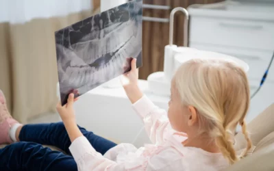 Radiografías dentales, ¿son imprescindibles?